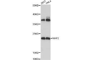 Western blot analysis of extracts of various cell lines, using NHP2 Antibody. (NHP2 anticorps)