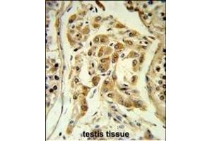 Formalin-fixed and paraffin-embedded human testis tissue reacted with ESPN Antibody (N-term), which was peroxidase-conjugated to the secondary antibody, followed by DAB staining.