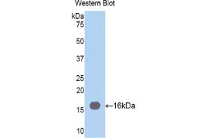 Western blot analysis of the recombinant protein. (Fascin anticorps  (AA 277-396))
