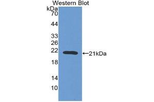 Western blot analysis of the recombinant protein. (Prothrombin anticorps  (AA 44-198))