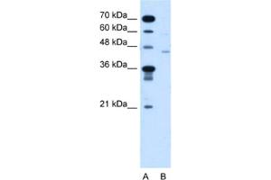 Western Blotting (WB) image for anti-Fukutin (FKTN) antibody (ABIN2464004) (Fukutin anticorps)