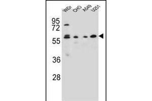 CEP70 Antibody (Center) (ABIN654603 and ABIN2844302) western blot analysis in WiDr,CHO,A549, cell line lysates (35 μg/lane). (CEP70 anticorps  (AA 309-338))