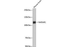Western blot analysis of extracts of Mouse brain, using NMD Rabbit mAb (ABIN7267417) at 1:1000 dilution. (GRIN1/NMDAR1 anticorps)