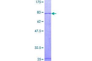 Image no. 1 for Vitamin K-dependent protein C (PROC) (AA 1-461) protein (GST tag) (ABIN1316355)