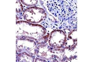 IL-6 antibody immunohistochemistry analysis in formalin fixed and paraffin embedded human kidney tissue.