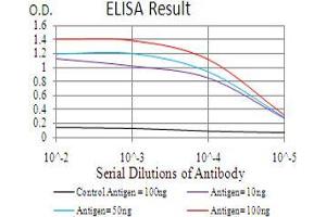 Black line: Control Antigen (100 ng), Purple line: Antigen(10 ng), Blue line: Antigen (50 ng), Red line: Antigen (100 ng), (KDM5B anticorps  (AA 231-319))