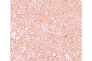 Immunohistochemical staining of human brain cells with NLRP10 polyclonal antibody  at 10 ug/mL. (NLRP10 anticorps  (N-Term))