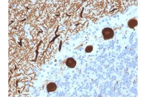 Formalin-fixed, paraffin-embedded human Cerebellum stained with CA8 Mouse Monoclonal Antibody (CPTC-CA8-2). (CA8 anticorps)
