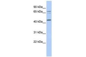Image no. 1 for anti-Queuine tRNA-Ribosyltransferase 1 (QTRT1) (AA 252-301) antibody (ABIN6741051) (QTRT1 anticorps  (AA 252-301))