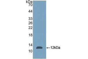 Detection of Recombinant NPM, Mouse using Polyclonal Antibody to Nucleophosmin 1 (NPM1)