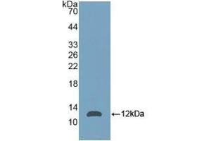 Detection of Recombinant NPM, Mouse using Polyclonal Antibody to Nucleophosmin 1 (NPM1) (NPM1 anticorps  (AA 212-292))