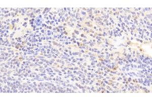 Detection of IL1RA in Rabbit Spleen Tissue using Polyclonal Antibody to Interleukin 1 Receptor Antagonist (IL1RA) (IL1RN anticorps  (AA 26-177))