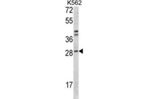 Western Blotting (WB) image for anti-Integrin beta 1 Binding Protein 3 (ITGB1BP3) antibody (ABIN3001631) (ITGB1BP3 anticorps)
