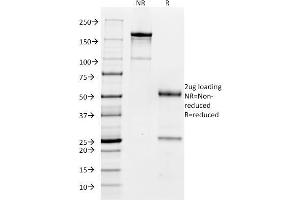 SDS-PAGE Analysis Purified CD32 Mouse Monoclonal Antibody (FCGR2A/479).