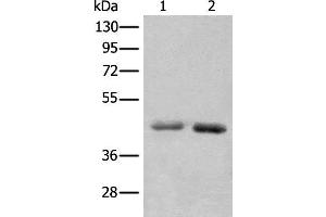 Western blot analysis of A549 and Hela cell lysates using NADK2 Polyclonal Antibody at dilution of 1:1000