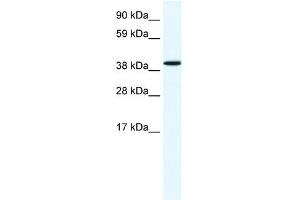 WB Suggested Anti-ANXA7 Antibody Titration:  1. (Annexin VII anticorps  (N-Term))