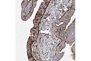 Immunohistochemical staining of human fallopian tube with LDLRAD3 polyclonal antibody  shows strong cytoplasmic and membranous positivity in glandular cells. (LDLRAD3 anticorps)