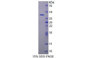 SDS-PAGE (SDS) image for Purine-Rich Element Binding Protein A (PURA) (AA 1-322) protein (His tag) (ABIN4989509) (PURA Protein (AA 1-322) (His tag))