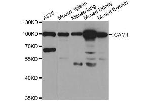 Western Blotting (WB) image for anti-Intercellular Adhesion Molecule 1 (ICAM1) antibody (ABIN1876800) (ICAM1 anticorps)