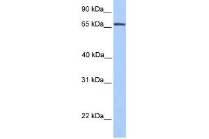 WB Suggested Anti-NR4A2 Antibody Titration: 1 ug/ml Positive Control: Hela cell lysate
