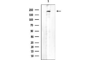 anti-Dedicator of Cytokinesis 4 (DOCK4) antibody