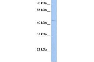 WB Suggested Anti-ZBTB6 Antibody Titration:  0. (ZBTB6 anticorps  (N-Term))