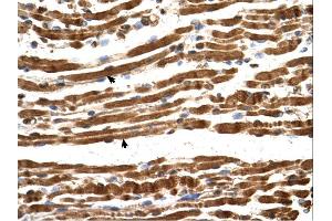 Immunohistochemistry (IHC) image for anti-N(alpha)-Acetyltransferase 16, NatA Auxiliary Subunit (NAA16) (Middle Region) antibody (ABIN311101) (NARG1L anticorps  (Middle Region))