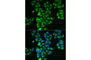 Immunofluorescence analysis of A549 cell using GLUD2 antibody. (GLUD2 anticorps)