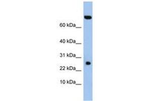 Image no. 1 for anti-Zinc Finger, SWIM-Type Containing 3 (ZSWIM3) (AA 35-84) antibody (ABIN6743750) (ZSWIM3 anticorps  (AA 35-84))