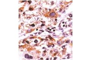 Image no. 1 for anti-Fibroblast Growth Factor Receptor 1 (FGFR1) (pTyr766) antibody (ABIN358128)