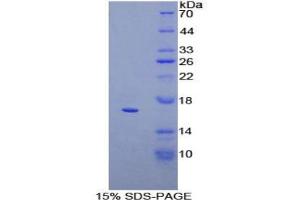 SDS-PAGE analysis of Human CD160 Protein. (CD160 Protein (CD160))