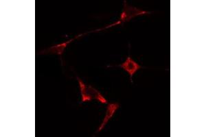 ABIN6274672 staining HepG2 cells by IF/ICC. (HSPB2 anticorps  (Internal Region))