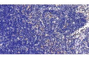 Detection of IL1RAP in Rat Lymph node Tissue using Polyclonal Antibody to Interleukin 1 Receptor Accessory Protein (IL1RAP)