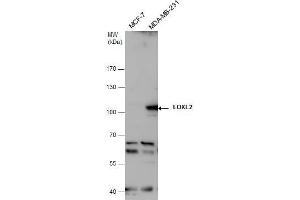 WB Image LOXL2 antibody detects LOXL2 protein by western blot analysis.