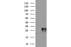 Western Blotting (WB) image for anti-Adiponectin (ADIPOQ) (AA 19-244) antibody (ABIN2715769) (ADIPOQ anticorps  (AA 19-244))