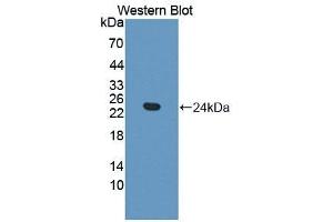 Detection of Recombinant Frataxin, Mouse using Polyclonal Antibody to Frataxin (FXN) (Frataxin anticorps  (AA 41-207))