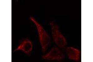ABIN6278649 staining HepG2 cells by IF/ICC. (CD28 anticorps  (pTyr218))