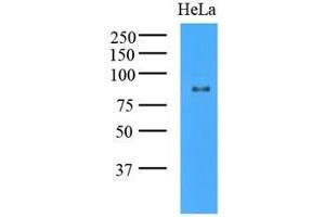 Western Blotting (WB) image for anti-K(lysine) Acetyltransferase 2A (KAT2A) (AA 411-837) antibody (ABIN487349) (KAT2A anticorps  (AA 411-837))