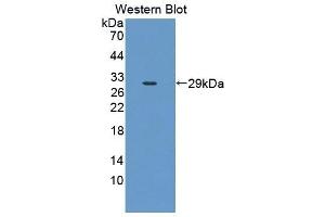 Detection of Recombinant CLTA, Mouse using Polyclonal Antibody to Clathrin, Light Polypeptide A (CLTA) (CLTA anticorps  (AA 5-234))