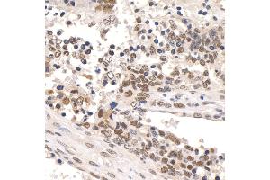anti-Paf1, RNA Polymerase II Associated Factor, Homolog (PAF1) (AA 475-525) antibody