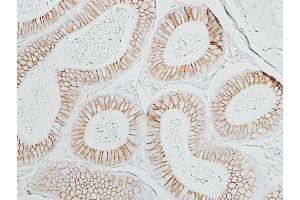 Immunohistochemistry (IHC) image for anti-Catenin, beta (CATNB) (AA 725-775) antibody (ABIN7454021)