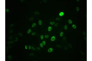 Immunofluorescence staining of Hela cells with ABIN7127717 at 1:100,counter-stained with DAPI.