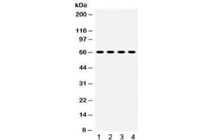 Western blot testing of 1) rat lung, human 2) HeLa, 3) K562 and 4) Jurkat lysate with GRK6 antibody.