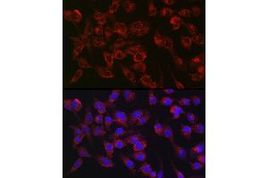 Immunofluorescence analysis of RD cells using Collagen III alpha 1/COL3 antibody (ABIN7266459) at dilution of 1:100.