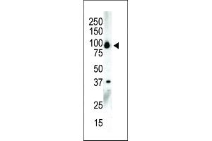 Western blot analysis of anti-PKCnu C-term Pab in NCI-H460 cell lysate (PRKD3 anticorps  (C-Term))