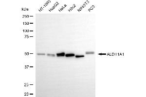 Western blotting analysis using ALDH1A1 antibody (ABIN7797555).