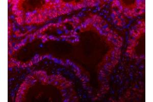 anti-Tigger Transposable Element Derived 1 (TIGD1) (AA 74-591) antibody