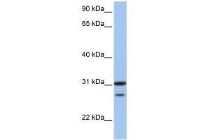 WB Suggested Anti-UBE2C Antibody Titration:  0. (UBE2C anticorps  (N-Term))