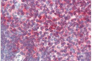 Human Thymus (formalin-fixed, paraffin-embedded) stained with CD44 antibody ABIN396970 at 5 ug/ml followed by biotinylated anti-mouse IgG secondary antibody ABIN481714, alkaline phosphatase-streptavidin and chromogen.