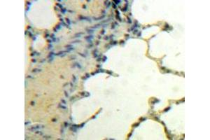 Used in DAB staining on fromalin fixed paraffin-embedded Lung tissue (BDNF anticorps  (AA 139-249))